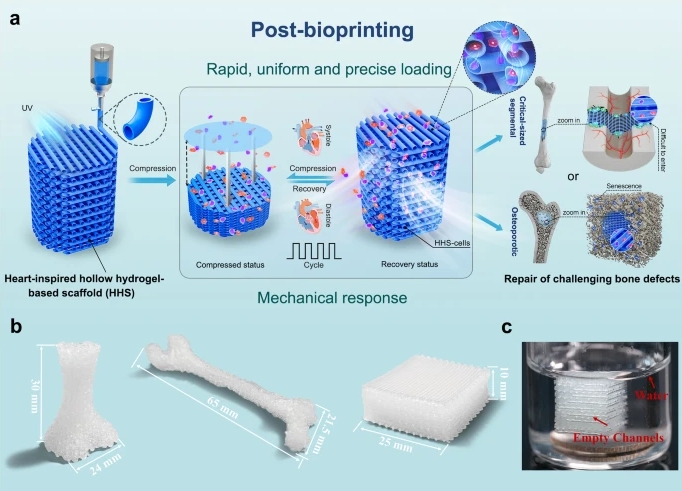 “生物3D打印＋” 实现难愈合骨缺损治疗