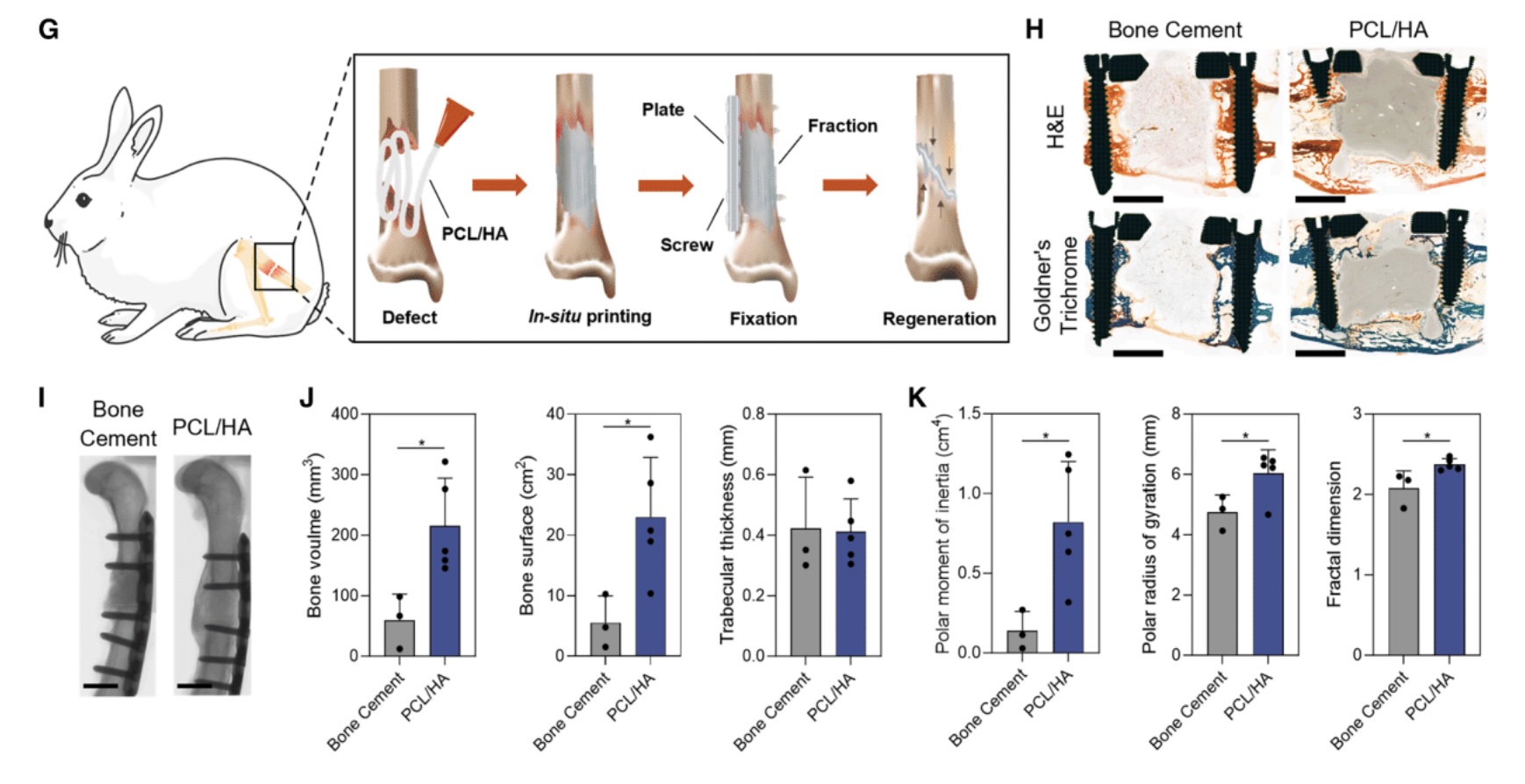 Handheld 3D Printer Achieves In Vivo Bone Repair: Successful Rabbit Experiment