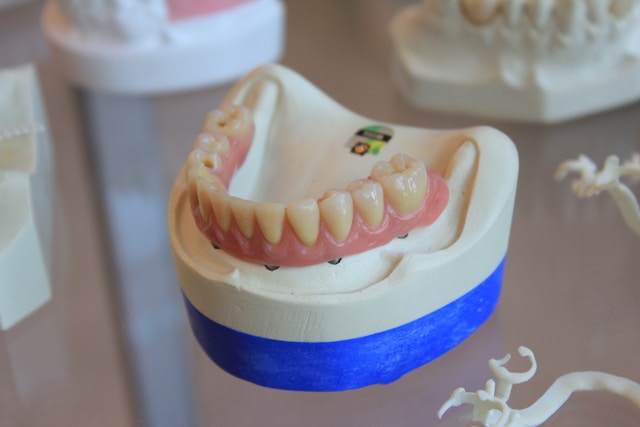 3D-printing breakthrough could give patients permanent dental crowns in hours