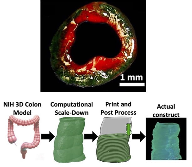 加州大学欧文分校研发3D仿生人造结肠模型推动癌症药物研发