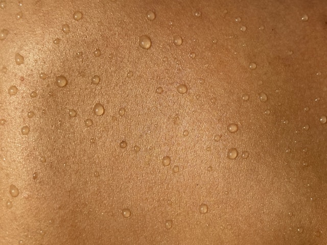 QUB develops dissolving 3D printed patch for skin cancer drugs