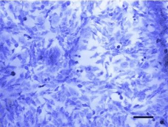 MIT与Johns Hopkins研发3D打印活细胞采集装置，为卵巢癌研究提供新路径